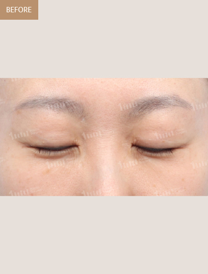 Before
