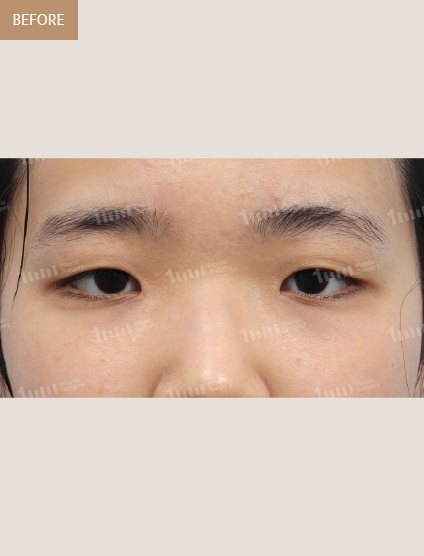 Before
