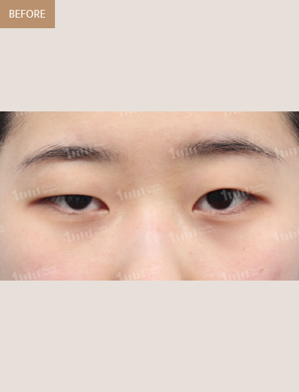 Before