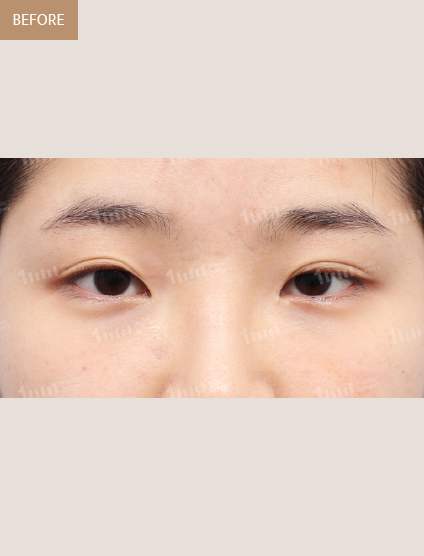 Before