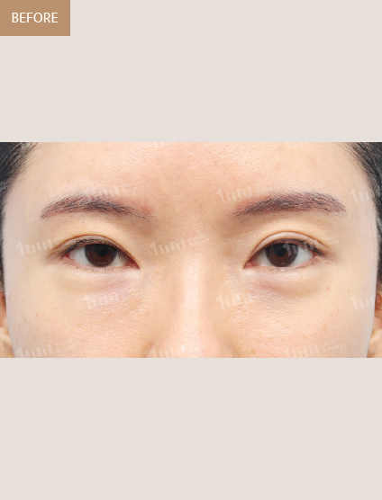 Before