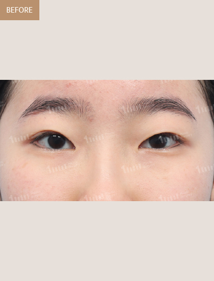 Before