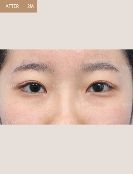 After
