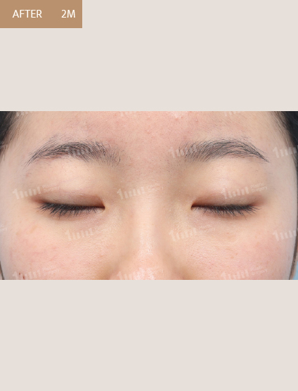 After