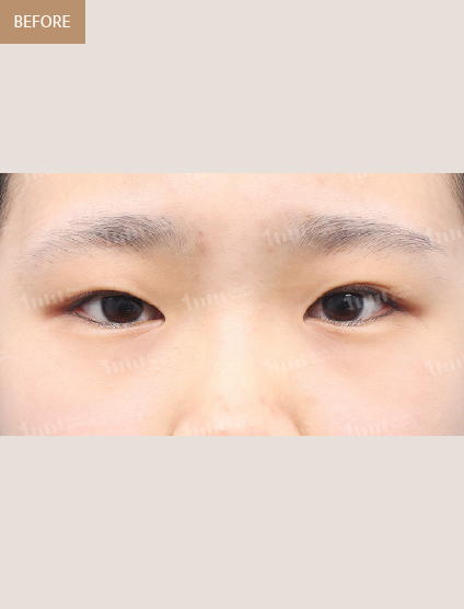 Before