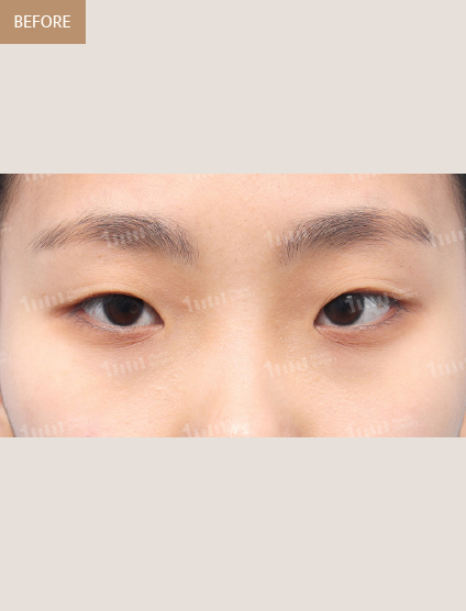 Before