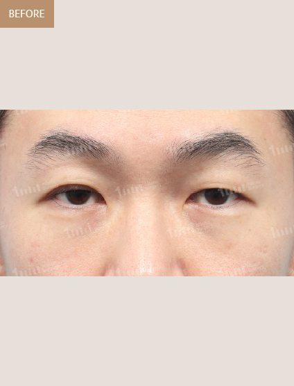 Before