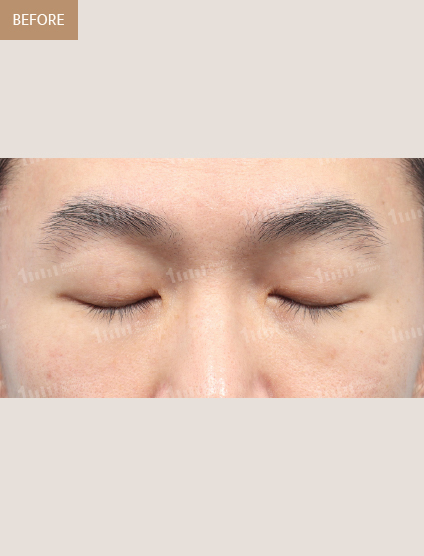Before