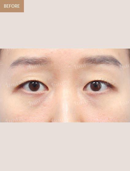 Before