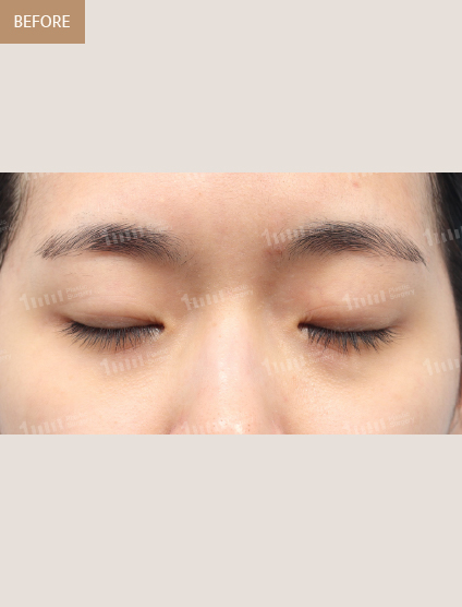 Before