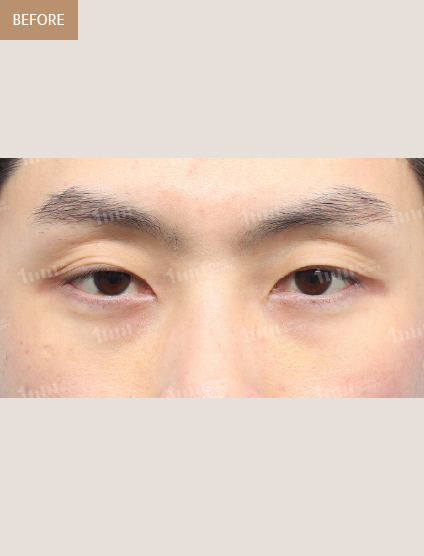 Before