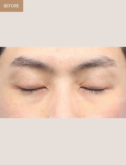 Before