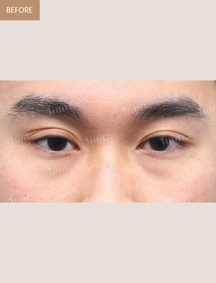 Before