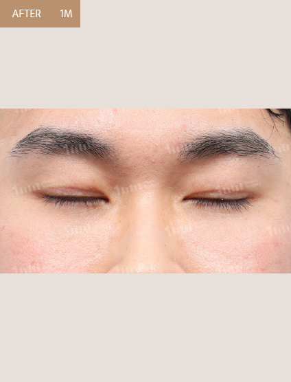 After