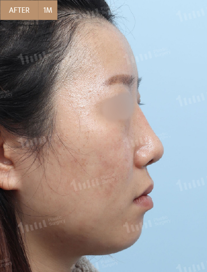 After