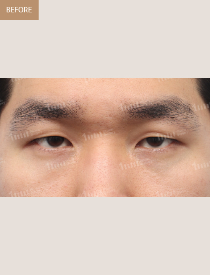 Before