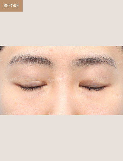 Before