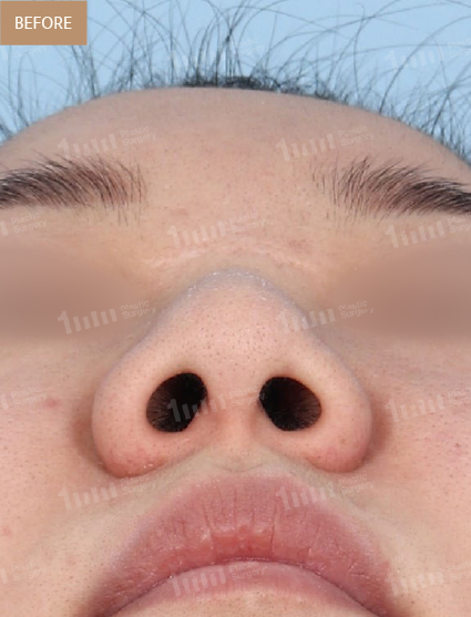 Before