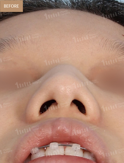 Before
