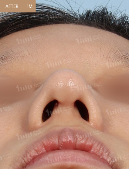 After