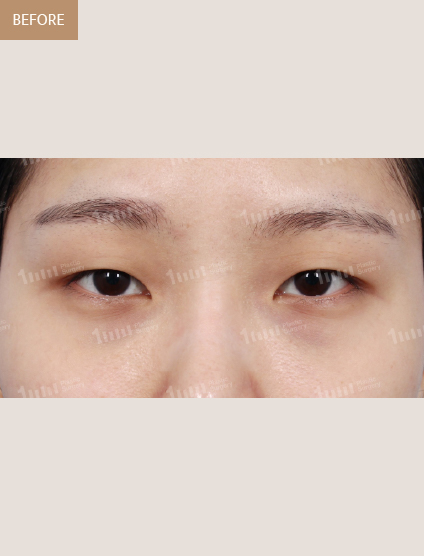 Before