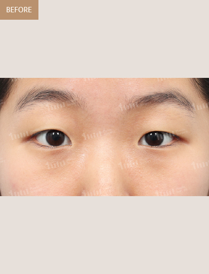Before