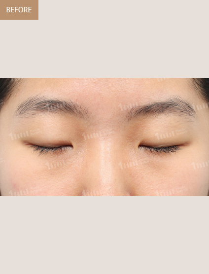 Before