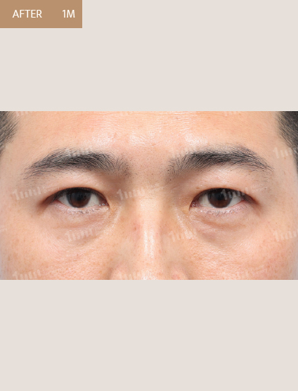 After