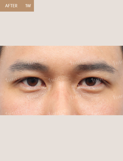 After
