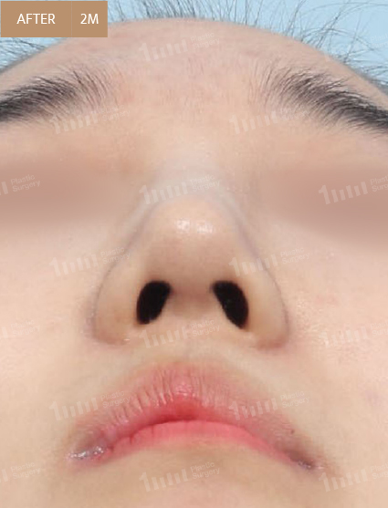 After