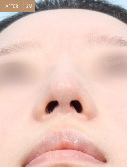 After