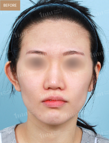 Before