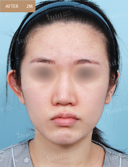 After