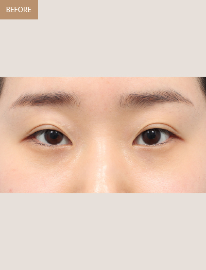 Before