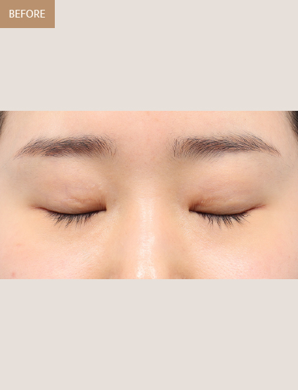 Before