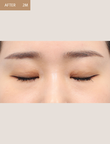After