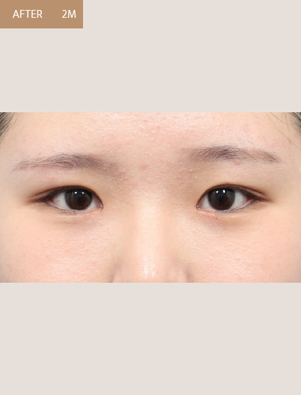 After