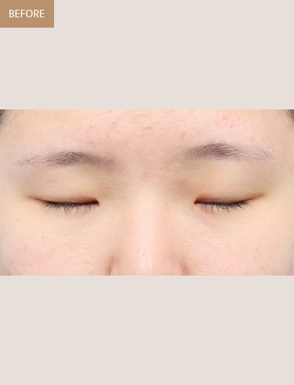 Before