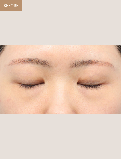 Before