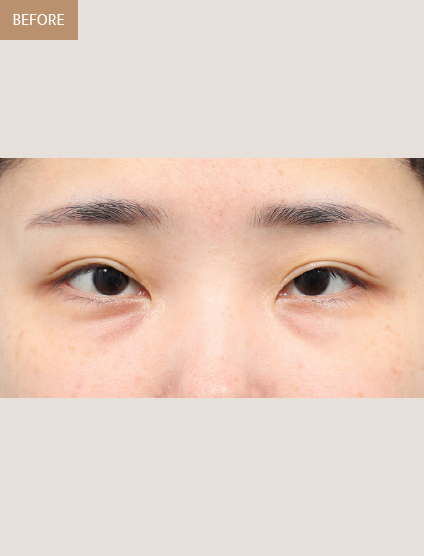 Before