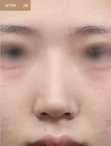 After