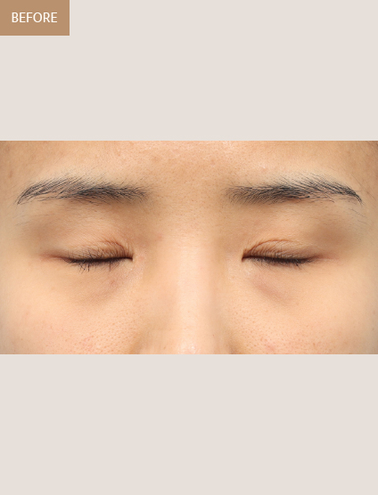 Before