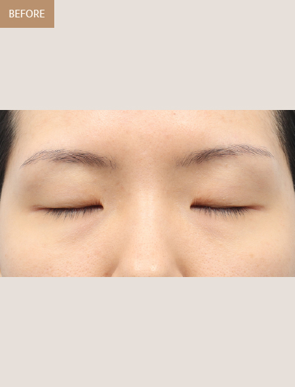 Before