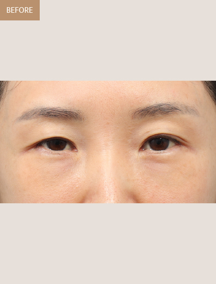 Before