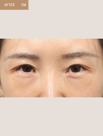 After