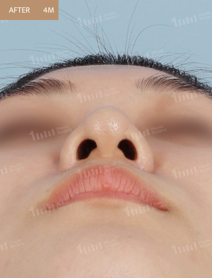 After