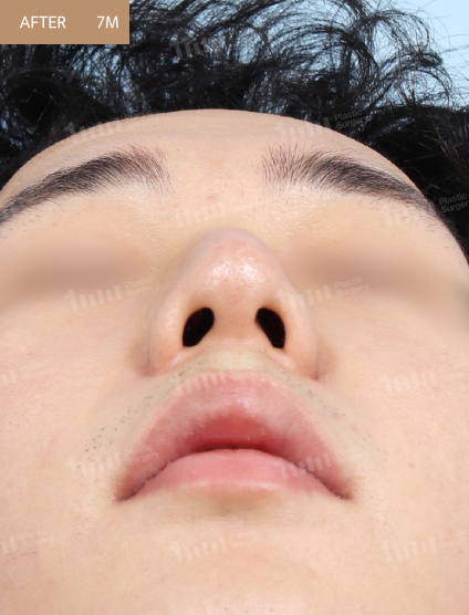 After