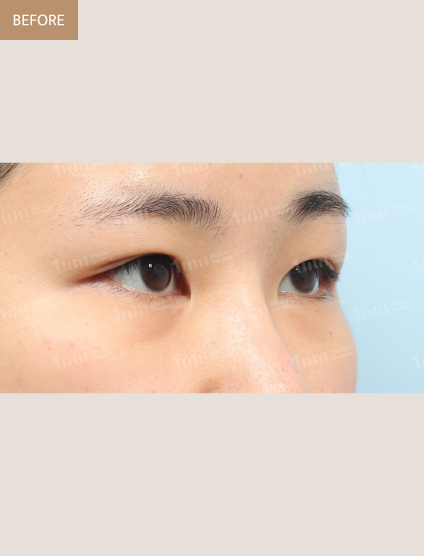 Before