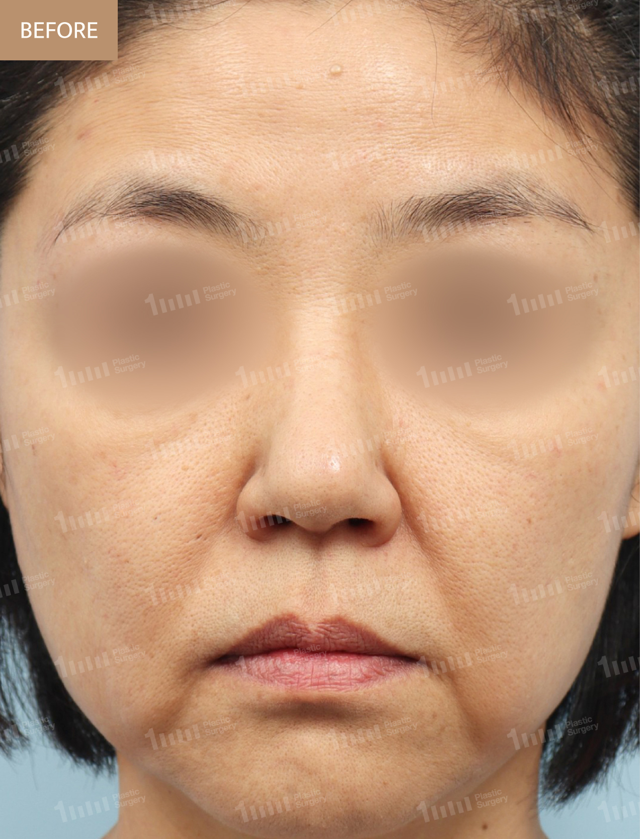 Before