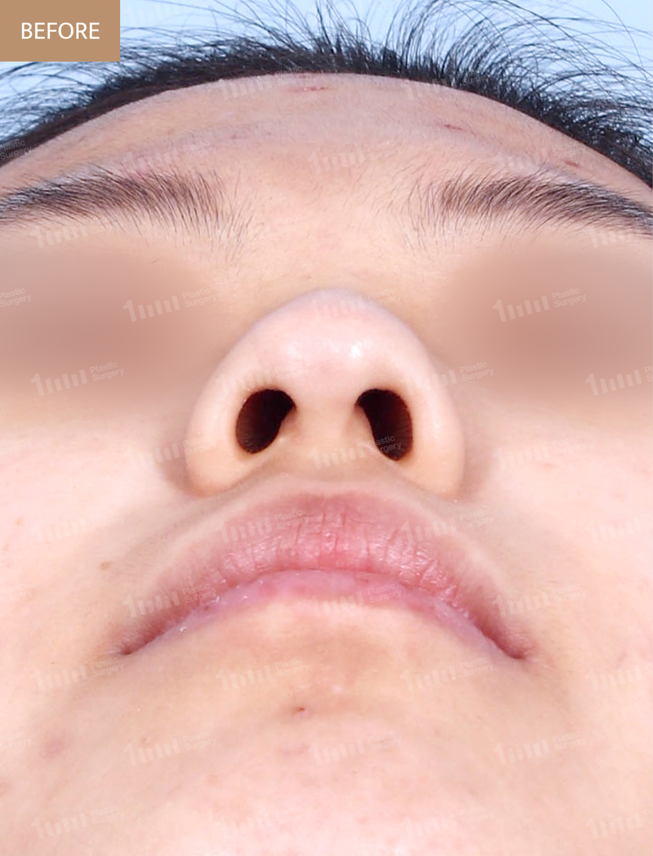 Before